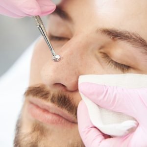 Blackhead Removal & Pore Purging Facial